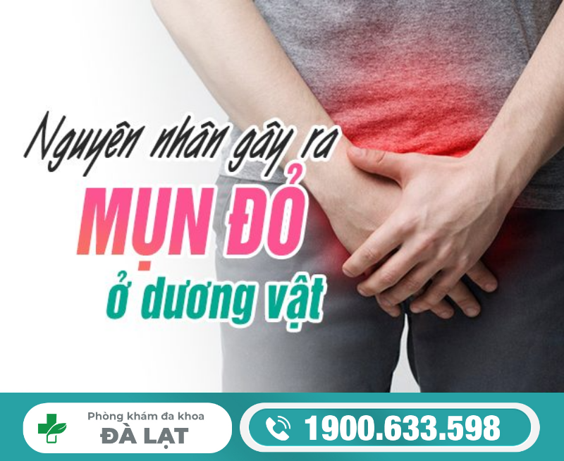 Hình ảnh minh họa